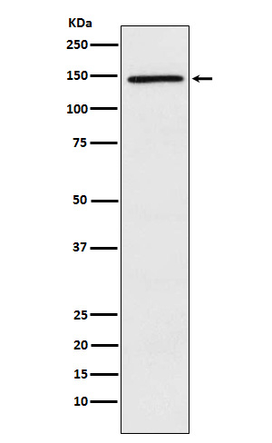 PLCG2 Antibody in Western Blot (WB)
