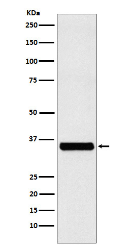 EXOSC7 Antibody in Western Blot (WB)