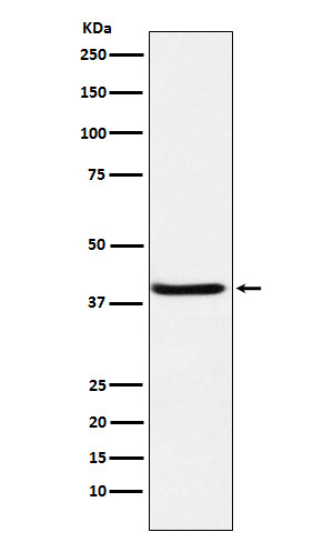 SERPINB3 Antibody in Western Blot (WB)