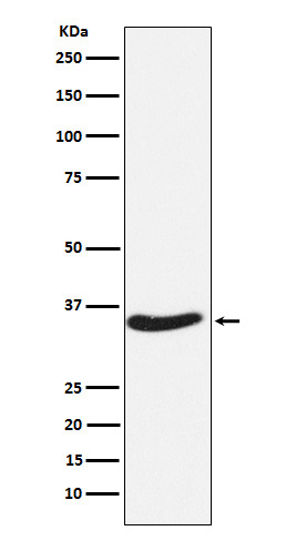 EXOSC7 Antibody in Western Blot (WB)