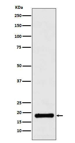 UBE2A/UBE2B Antibody in Western Blot (WB)