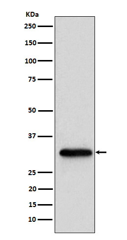 NUDT5 Antibody in Western Blot (WB)