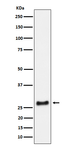 SNRPA1 Antibody in Western Blot (WB)