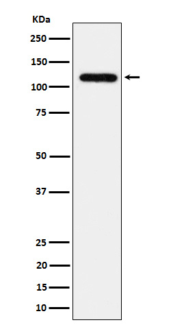 UBE4A Antibody in Western Blot (WB)