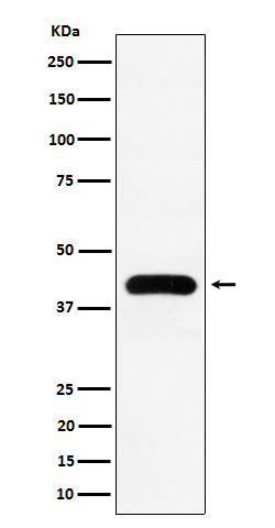 MVD Antibody in Western Blot (WB)