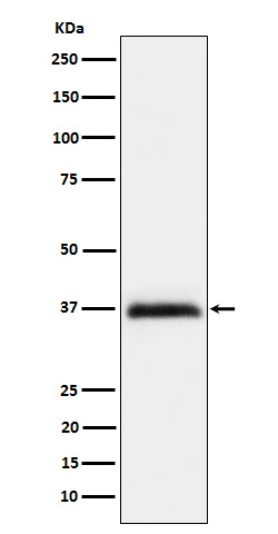 RGMA Antibody in Western Blot (WB)