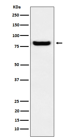 PRKCSH Antibody in Western Blot (WB)
