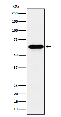 CoA Synthase Antibody in Western Blot (WB)