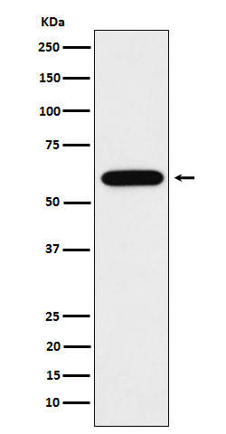 TUB Antibody in Western Blot (WB)
