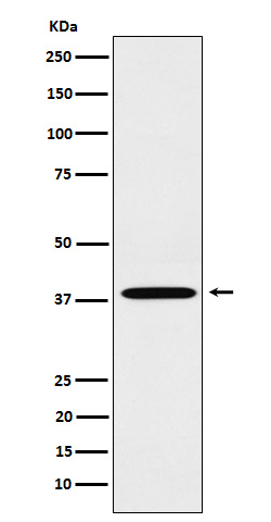 LTB4R Antibody in Western Blot (WB)