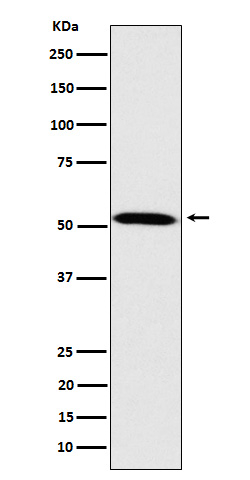 FKTN Antibody in Western Blot (WB)