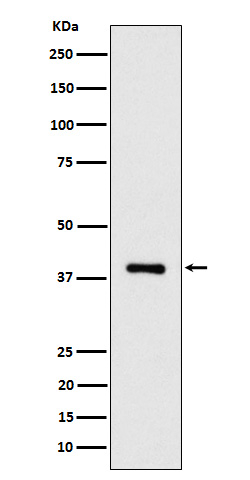 ACAT2 Antibody in Western Blot (WB)