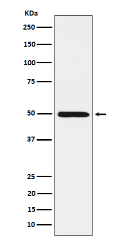 HGD Antibody in Western Blot (WB)