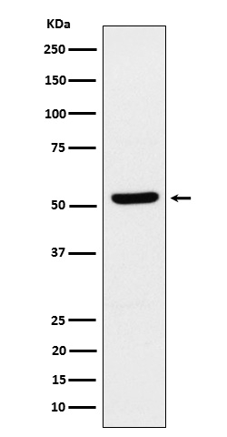 ZPR1 Antibody in Western Blot (WB)