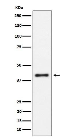 IL15RA Antibody in Western Blot (WB)