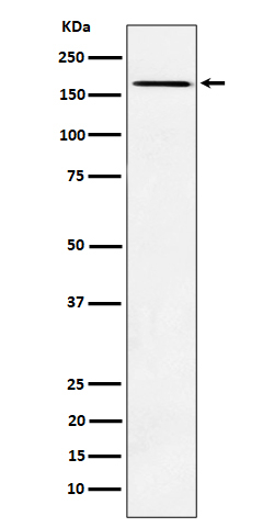 AGL Antibody in Western Blot (WB)
