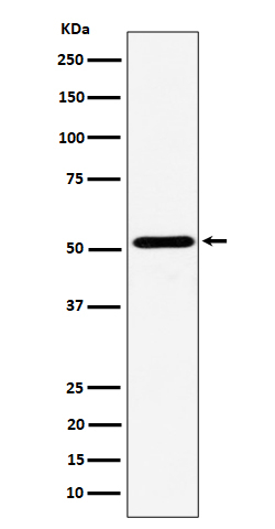 NPY5R Antibody in Western Blot (WB)