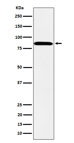 PPM1E Antibody in Western Blot (WB)