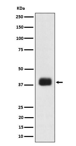 SR protein repeat Antibody in Western Blot (WB)