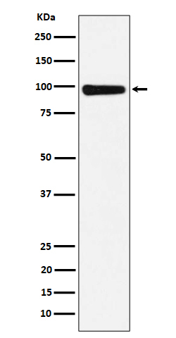 CHM Antibody in Western Blot (WB)