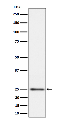 MRPS15 Antibody in Western Blot (WB)