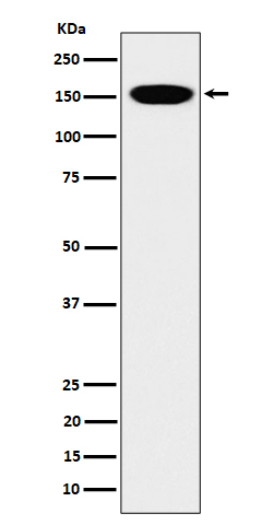 NCAPD2 Antibody in Western Blot (WB)