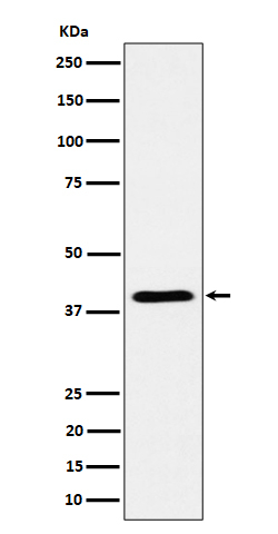ADH4 Antibody in Western Blot (WB)