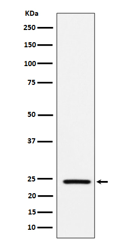Acetyl-SOD2 (Lys68) Antibody in Western Blot (WB)
