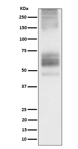 SSTR1 Antibody in Western Blot (WB)