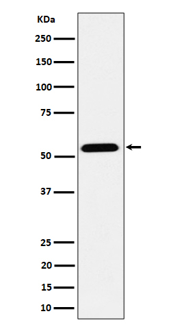 ENPP5 Antibody in Western Blot (WB)