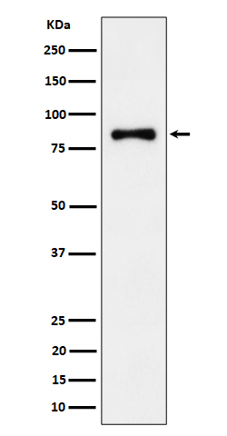 ALDH16A1 Antibody in Western Blot (WB)