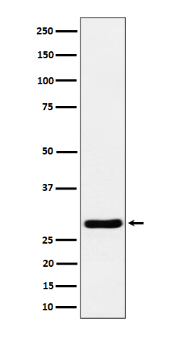 RCAN1 Antibody in Western Blot (WB)
