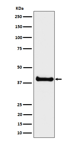 ALS2CR1 Antibody in Western Blot (WB)
