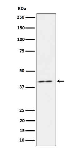 IL18BP Antibody in Western Blot (WB)