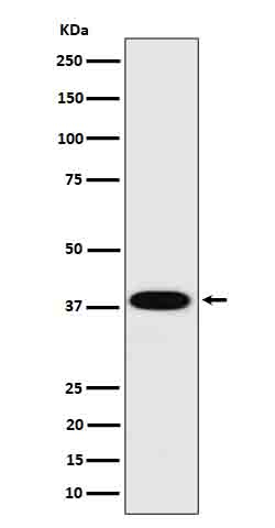 Cathepsin H Antibody in Western Blot (WB)