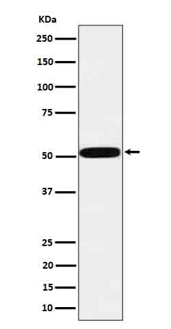 HTRA1 Antibody in Western Blot (WB)