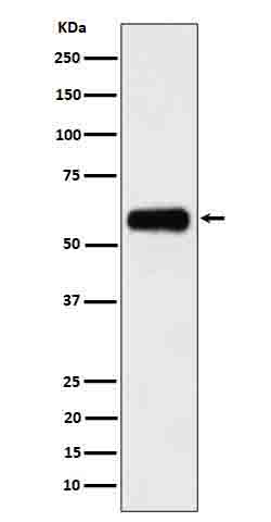 CD116 Antibody in Western Blot (WB)