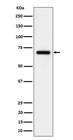 IL5RA Antibody in Western Blot (WB)