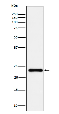 UBE2T Antibody in Western Blot (WB)