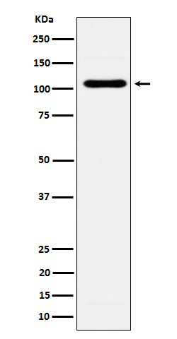 EXOC2 Antibody in Western Blot (WB)