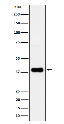 CXCR6 Antibody in Western Blot (WB)