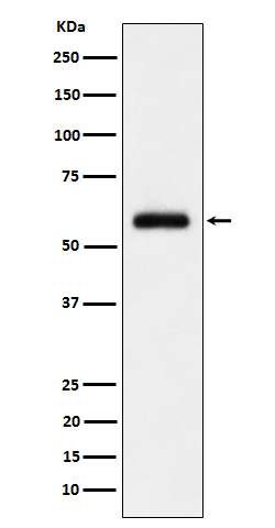 GTF2E1 Antibody in Western Blot (WB)