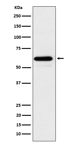 Cdc73 Antibody in Western Blot (WB)