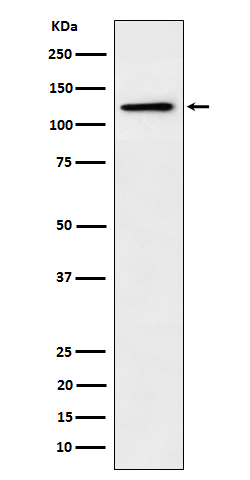 Palladin Antibody in Western Blot (WB)