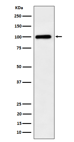 DSC1 Antibody in Western Blot (WB)