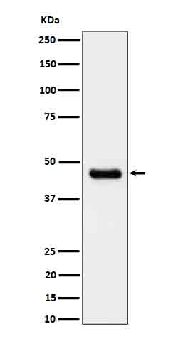 CABP1 Antibody in Western Blot (WB)