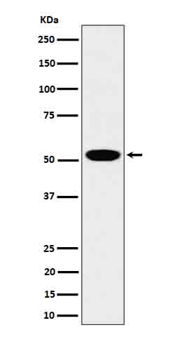 LAP3 Antibody in Western Blot (WB)