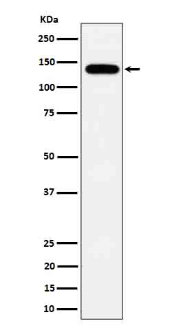 TPP2 Antibody in Western Blot (WB)