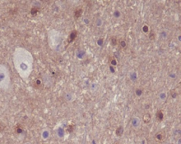 Phospho-PAK1/2/3 (Ser144, Ser141, Ser139) Antibody in Immunohistochemistry (Paraffin) (IHC (P))