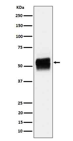 Phospho-Tau (Ser202) Antibody in Western Blot (WB)